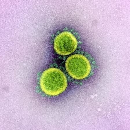 ウイルス（電子顕微鏡）.jpg